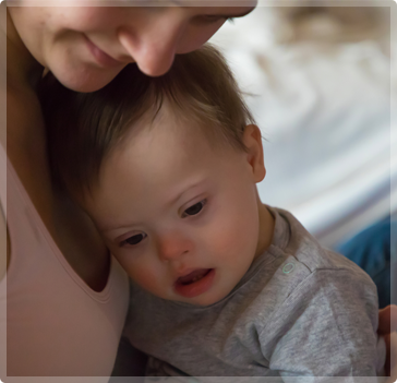 Down Syndrome Baby - Guadalupe Medical Center