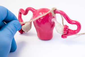 reversing tubal ligation